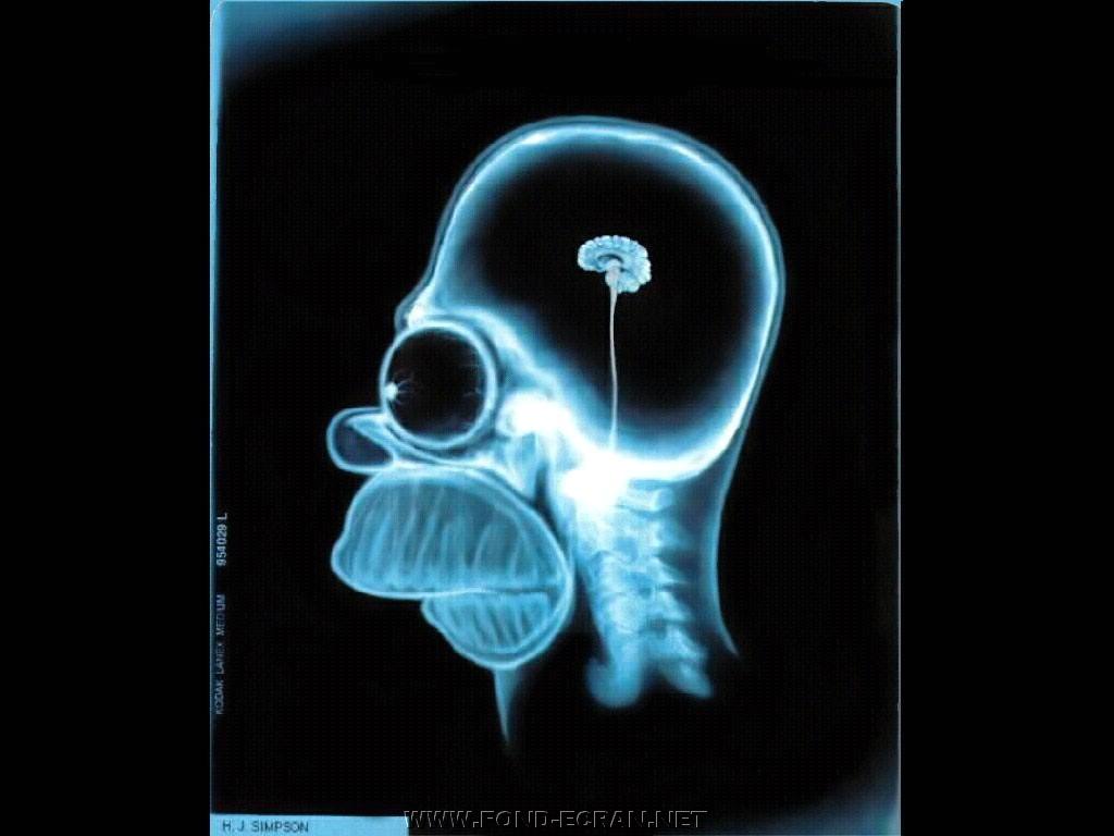 cerveau de Homer Simpson fond ecran cerveau de Homer Simpson
